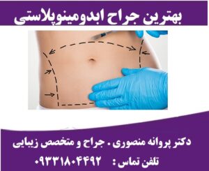 هزینه عمل جراحی ابدومینوپلاستی در تهران